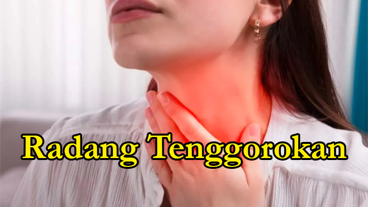 radang tenggorokan